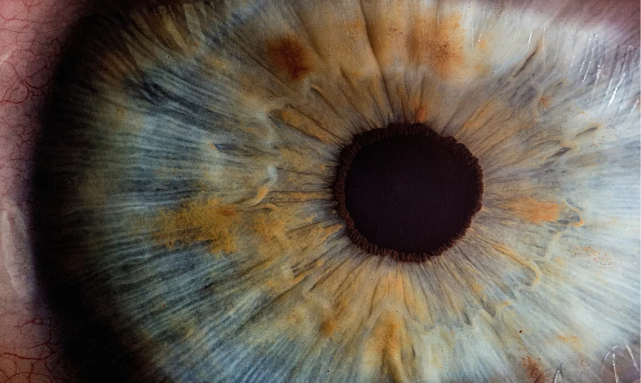A close up photo of eye's retina