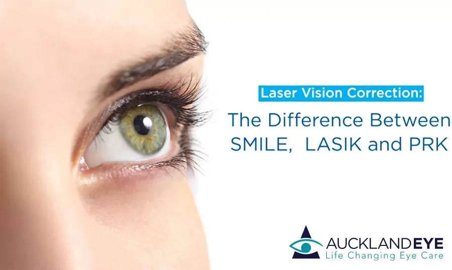 The Difference Between SMILE, LASIK and PRK