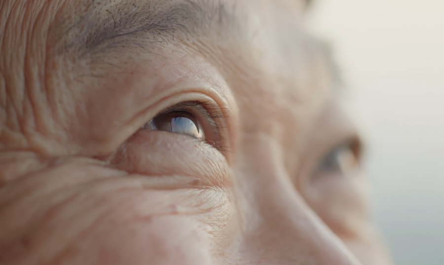 Age-Related Macular Degeneration