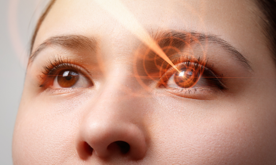 Frequently Asked Questions: SMILE Laser Vision Correction