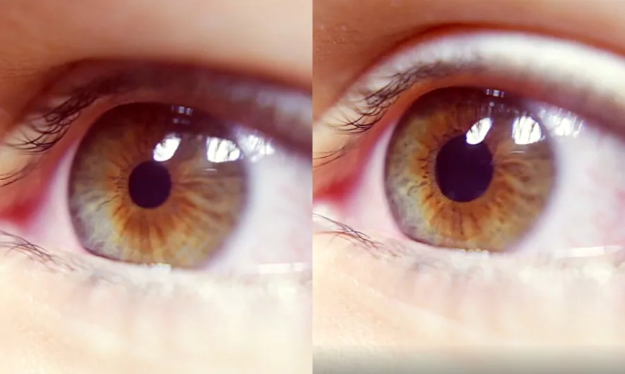 7 reasons your pupils change size