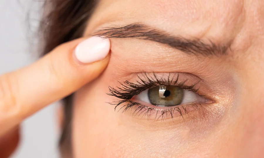 Blepharoplasty - photo of an eye